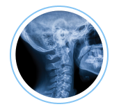 X-Rays